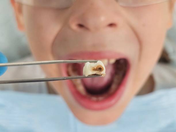 Best Same-Day Emergency Dentist in Lakeside, VA